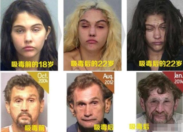 毒品检测知多少