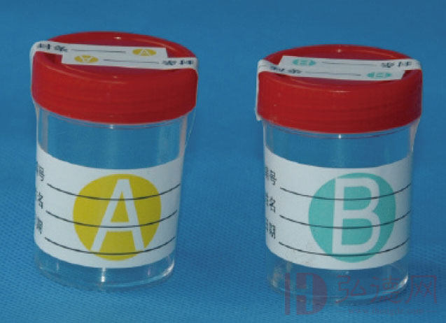 尿液包装AB瓶及标签