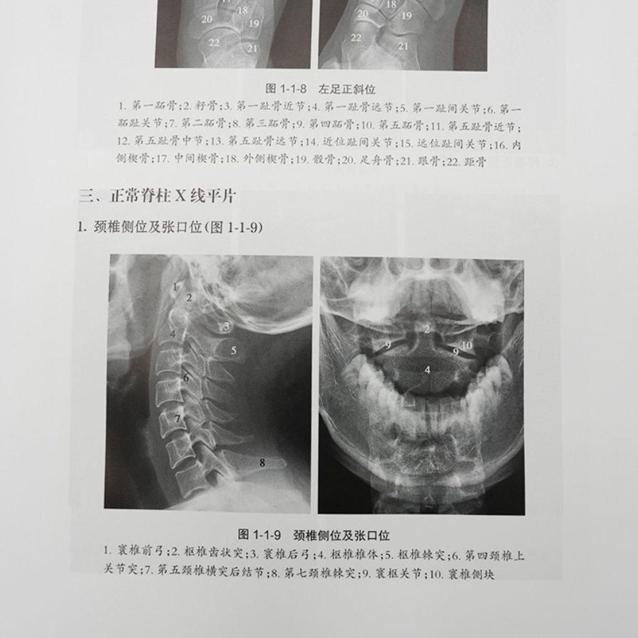 医学影像学读片诊断图谱 骨肌分册 第2版 法医临床病理鉴定胸部头颈腹部骨肌放射医学超声参考书X光CT影像MRI诊断指南