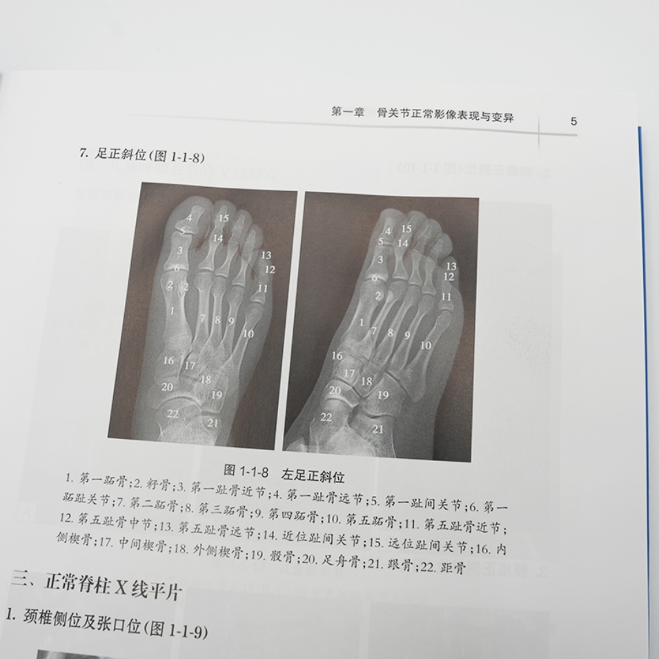 医学影像学读片诊断图谱 骨肌分册 第2版 法医临床病理鉴定胸部头颈腹部骨肌放射医学超声参考书X光CT影像MRI诊断指南
