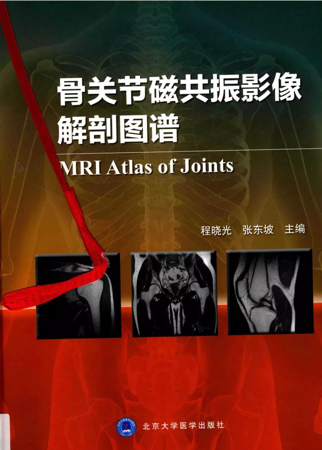 骨关节磁共振影像解剖图谱 [MRI Atlas of Joints]