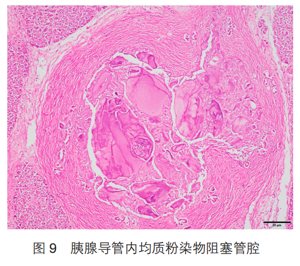 法医病理司法鉴定实务 | 全国司法鉴定教育培训系列教材 | 官大威、张建华、周亦武、何光龙、陈忆九编著