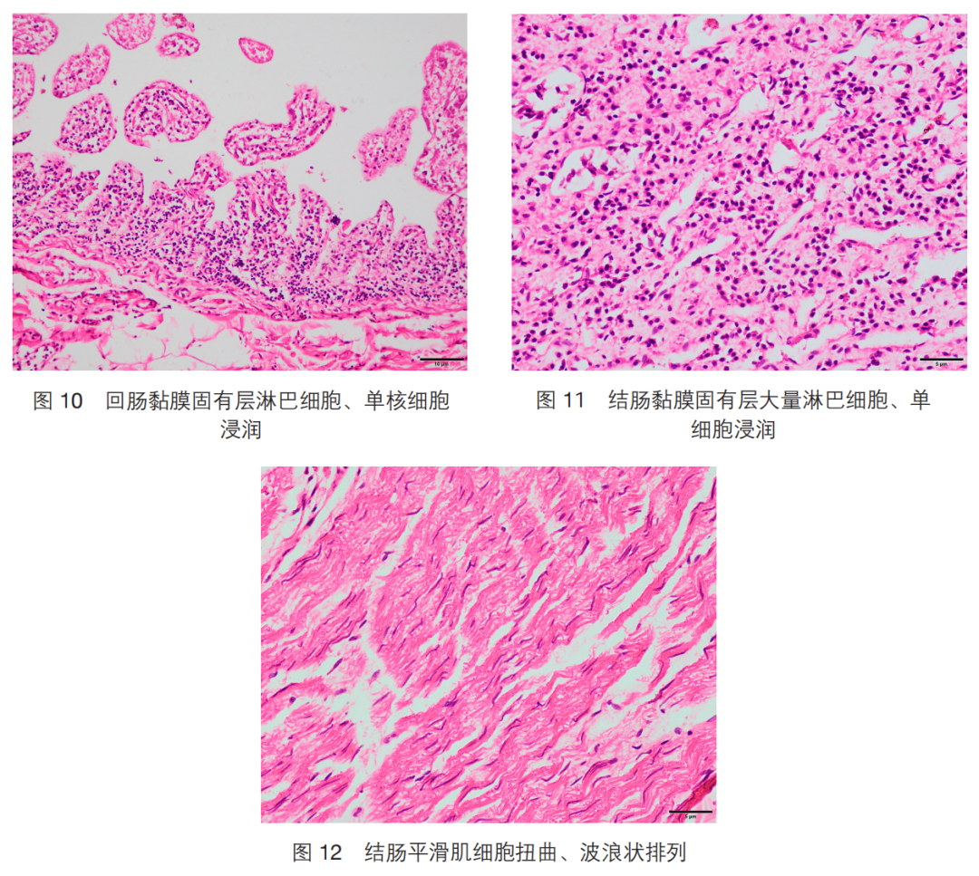 法医病理司法鉴定实务 | 全国司法鉴定教育培训系列教材 | 官大威、张建华、周亦武、何光龙、陈忆九编著