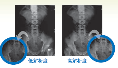 Medi-6000 Plus 胶片扫描仪