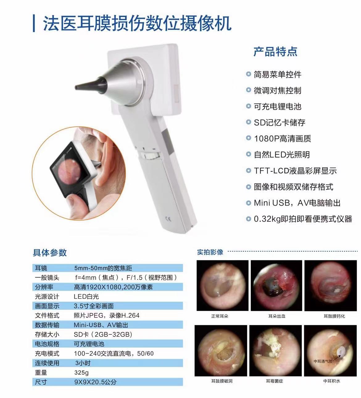  HMBS4可视化鼓膜照相仪、数字检耳镜